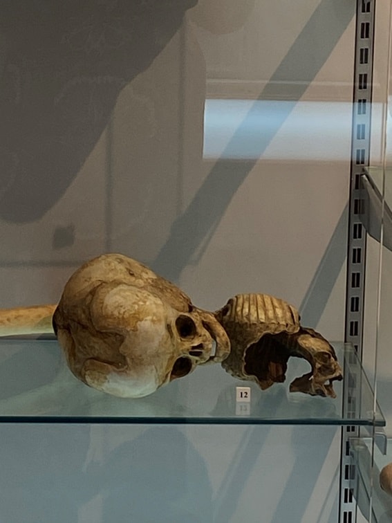 4 1 Crónica de una cautivadora visita al Museo de Antropología Médica-Forense ‘Profesor Reverte Coma’ 4 1 Crónica de una cautivadora visita al Museo de Antropología Médica-Forense ‘Profesor Reverte Coma’